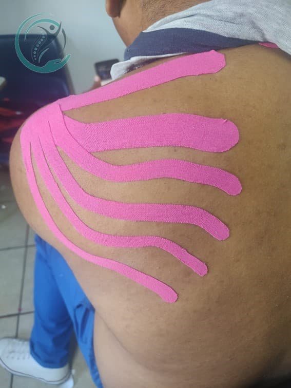 Imagen  - Terapia Física 12