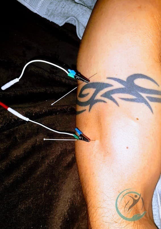 Imagen  - Terapia Física 13