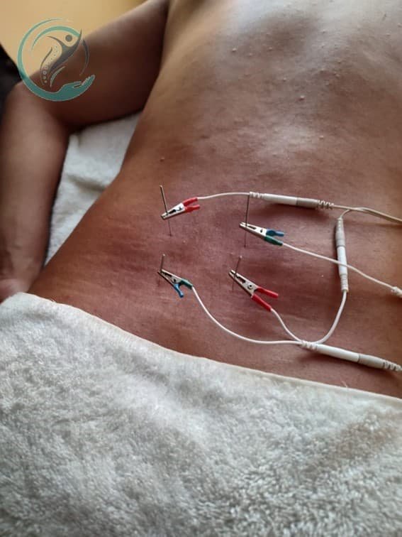 Imagen  - Terapia Física 14