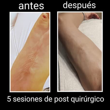 Imagen  - Terapia Física 7